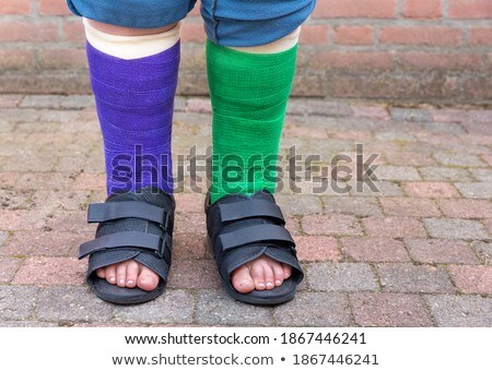 Stockfoto: Standing Child With Two Colorful Gypsum Legs