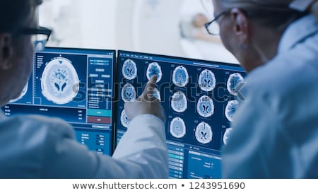 Foto stock: Magnetic Resonance Imaging Of The Brain Mri Scan