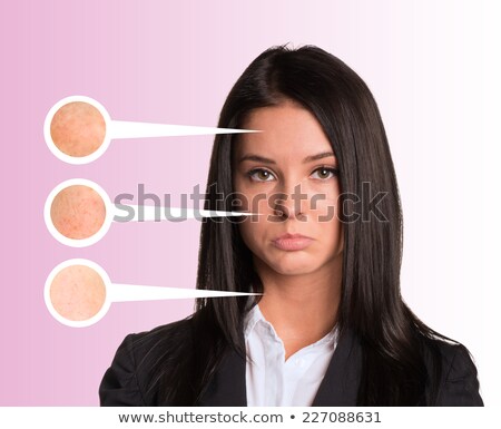 Upset Young Woman Callouts With Zoom Portions Of Skin Stockfoto © cherezoff