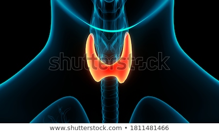 Stock fotó: 3d Rendered Illustration Of The Male Thyroid Gland - Cancer