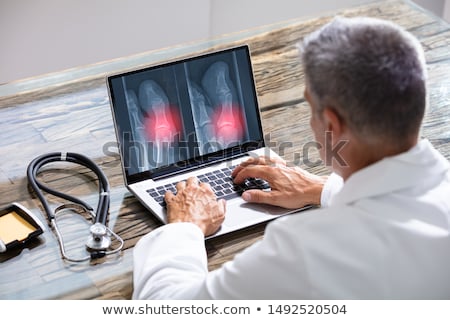 Stockfoto: X Ray Of Knee Showing Knee Pain