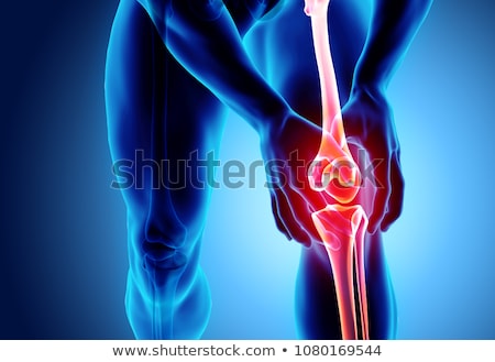 Stock photo: Knee Osteoarthritis