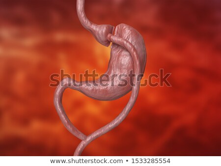 Stock photo: Gastric Bypass To Reduce Stomach
