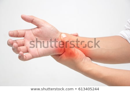 Stockfoto: Lupus Disease