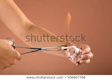 Stok fotoğraf: Therapist Holding Lit Camphor With Tong And Cup