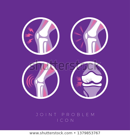 Zdjęcia stock: Joint Restoration Icon Vector Outline Illustration