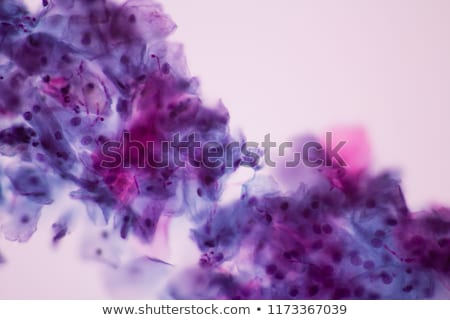 Stock foto: Vaginal Infection Bacteria Concept