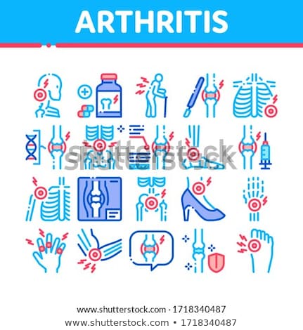 Zdjęcia stock: Human Joint