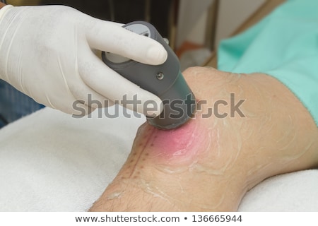 Foto d'archivio: Physiotherapist Is Applying Ultrasound Therapy On The Knee Injur