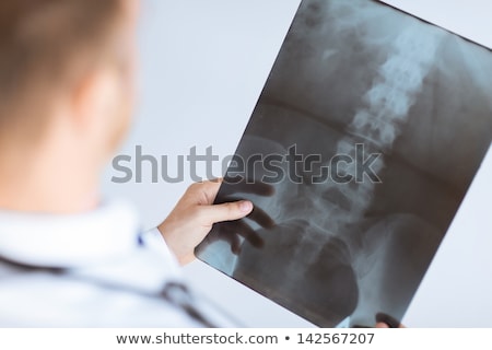 ストックフォト: Doctors With X Ray Of Spine At Hospital