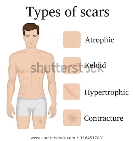 Stock photo: Scar 4