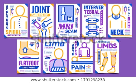 Foto stock: Orthopedic Treatment Promo Posters Set Vector