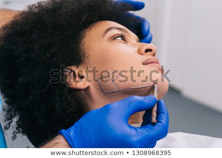 Foto stock: Surgeon Drawing Correction Lines On Woman Face