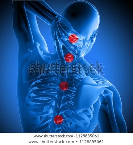 Foto stock: 3d Blue Medical Figure Holding Head In Pain