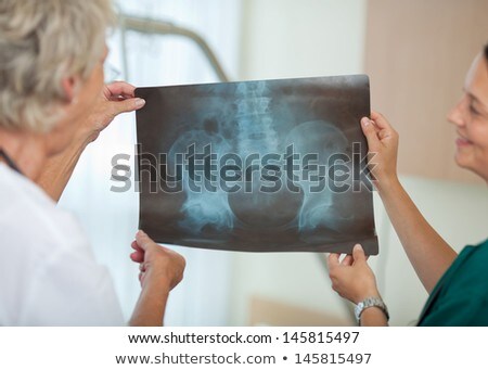 Foto stock: Surgeon And Doctor Discussing X Ray Report