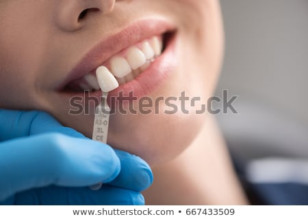Stock photo: Teeth Implant Model And Dental Instruments
