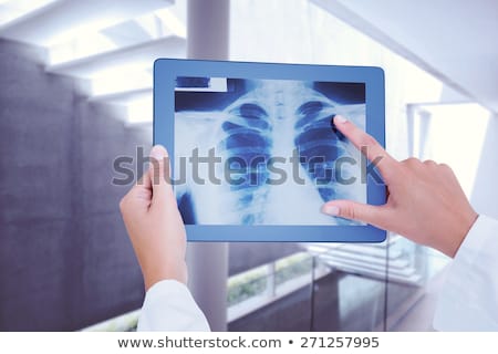 Stock fotó: Composite Image Of Doctor Looking At Xray On Tablet