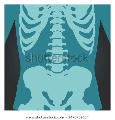 X Ray Shot Of Spinal Column Pelvis And Rib Cage Human Body Bones Radiography Vector Illustration Zdjęcia stock © MarySan