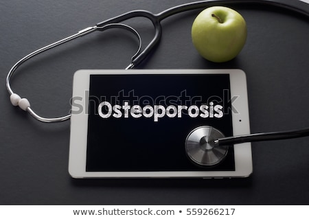 Stok fotoğraf: Checking The Osteoporosis