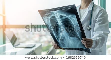 ストックフォト: X Ray Of Lungs