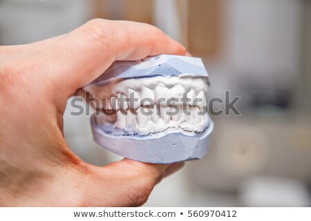 Foto stock: Dental Mould And Hand