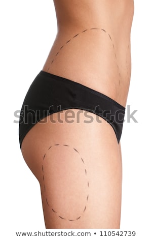 Stock photo: Body Correction With The Help Of Plastic Surgery On White Background Side View