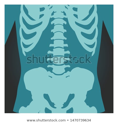 Stock fotó: X Ray Shot Of Pelvis And Spinal Column Human Body Bones Radiography Vector Illustration