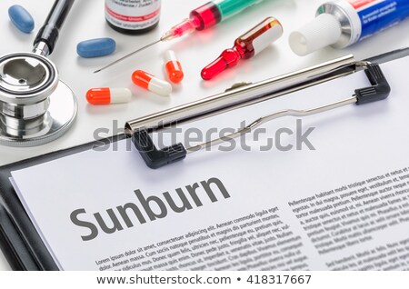 Stock photo: The Diagnosis Sunburn Written On A Clipboard