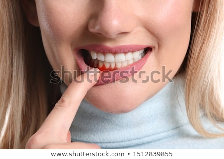 Сток-фото: Periodontitis