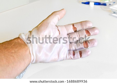 Foto d'archivio: Hand Physiotherapy To Recover A Finger