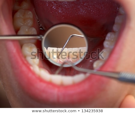 Foto stock: Extensive Dental Examination