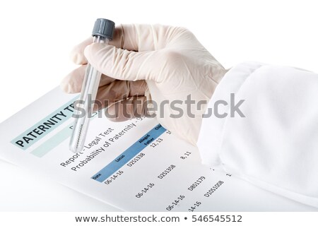 Foto stock: Paternity Test Result Form With Buccal Swab