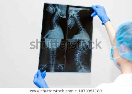 Zdjęcia stock: Osteochondrosis Diagnosis Medical Concept