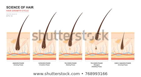 Foto d'archivio: Hair Growth Anagen Catagen And Telogen