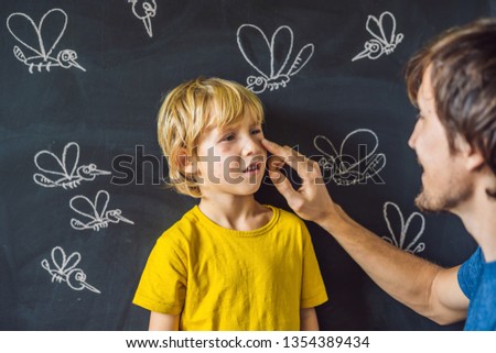 Сток-фото: The Boy Is Bitten By Mosquitoes On A Dark Background Dad Smears His Bite Ointment On The Blackboar