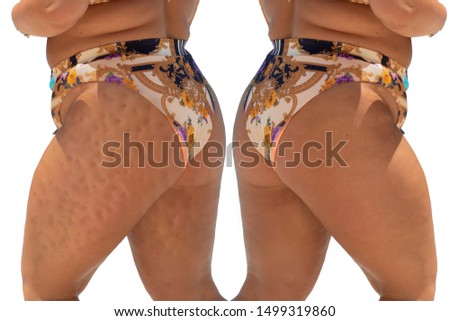 Stockfoto: Of Girl Thighs In Orange Bikini