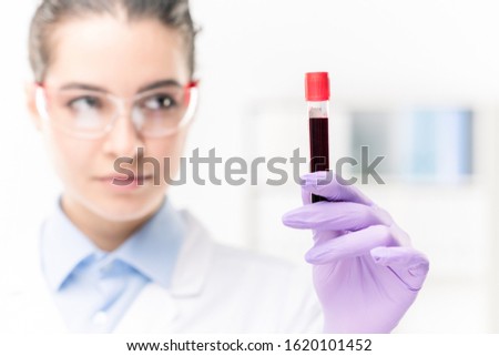 ストックフォト: Gloved Hand Of Young Female Clinician Or Chemist Holding Flask