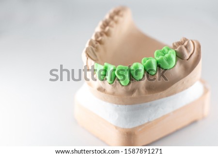 Stock foto: Close Up Dental Technician Work On Denture Prothesis In Dental L