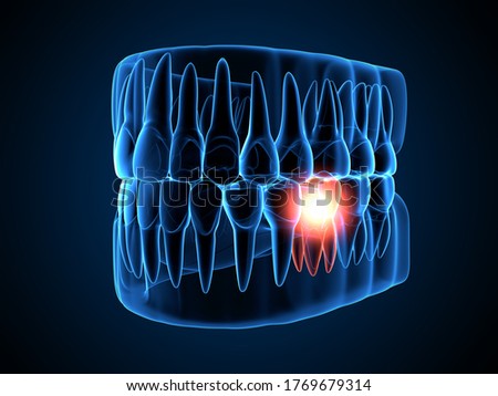 ストックフォト: X Rays Of The Jaw And Teeth