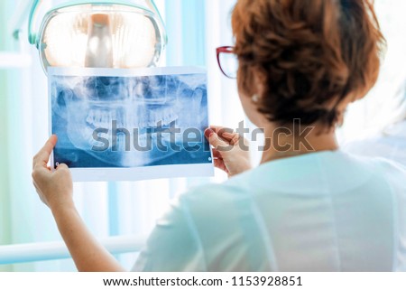 Сток-фото: Panoramic Dental X Ray Of A Human Jaw Holding In The Hands Of Th