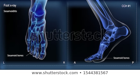 ストックフォト: Bone X Ray Image Of Human Joints Orthopedic Vector