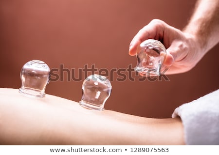 Foto d'archivio: Therapist Placing Glass Cups On Womans Back