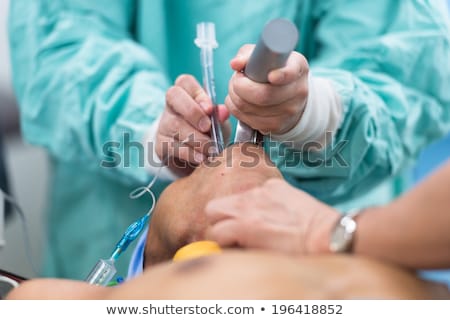 Insertion Endotracheal Tube Foto stock © ChaNaWiT