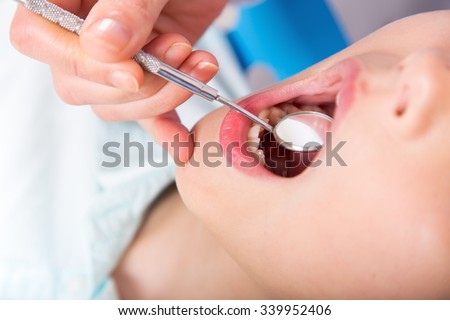 Zdjęcia stock: Close Up Of Female With Open Mouth During Oral Checkup At The De