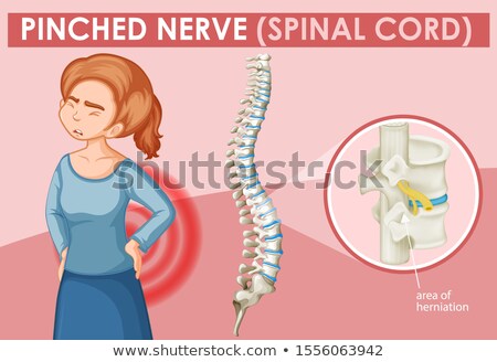 Stockfoto: Woman With Pinched Nerve On Poster