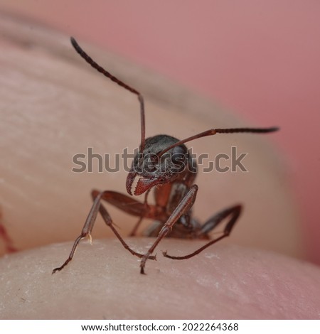 Foto stock: Large Mosquito Bite On Mans Finger