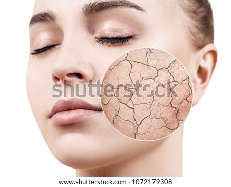 Foto stock: Aging And Dry Face Skin Concept - Woman With Magnifying Glass