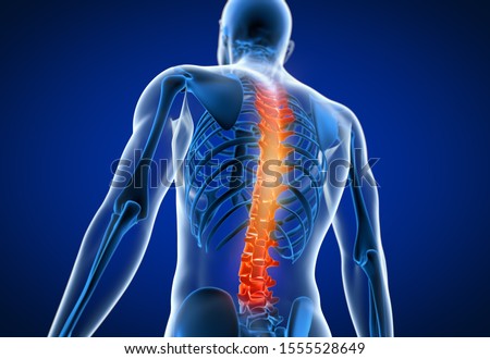 3d Render Painful Spine Stockfoto © cla78