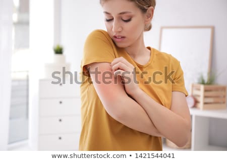 [[stock_photo]]: Scratched Arms