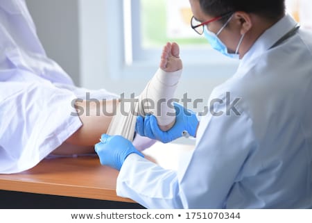 Stockfoto: Sprained Foot